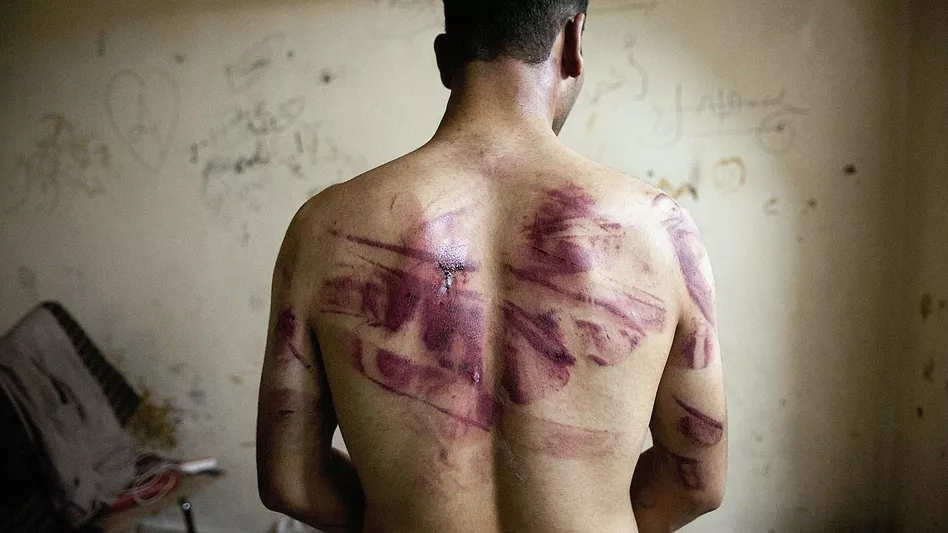 Deutsche Staatsanwälte gegen Assads Folterknechte